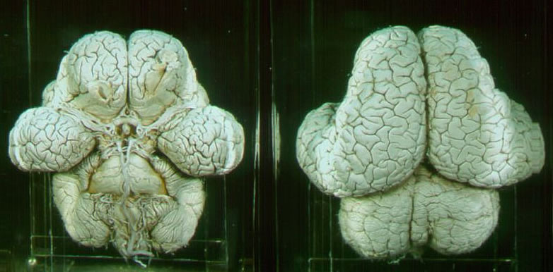 the brain of an elephant